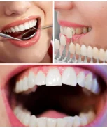 Best-Cosmetic-Dentist-in-NYC-1024×1024 Best-Cosmetic-Dentist-in-NYC-1024x1024